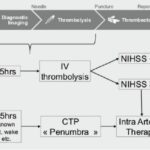 Stroke care pathway